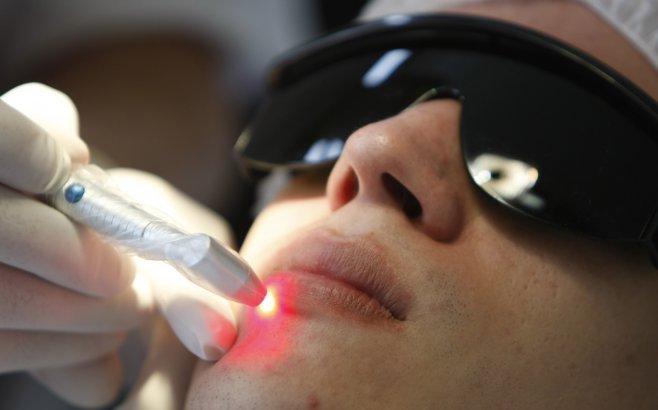 Laser Terapeutico Facial en Puerto Vallarta