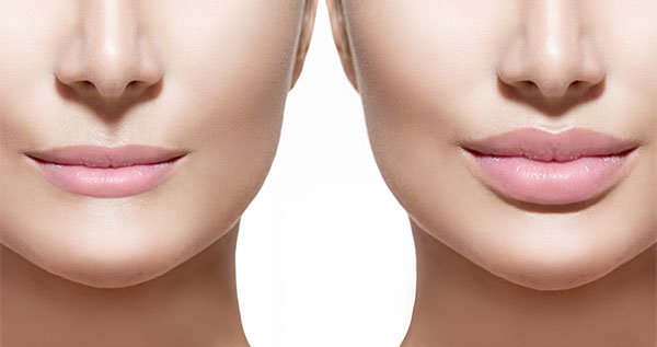 Delineado de labios