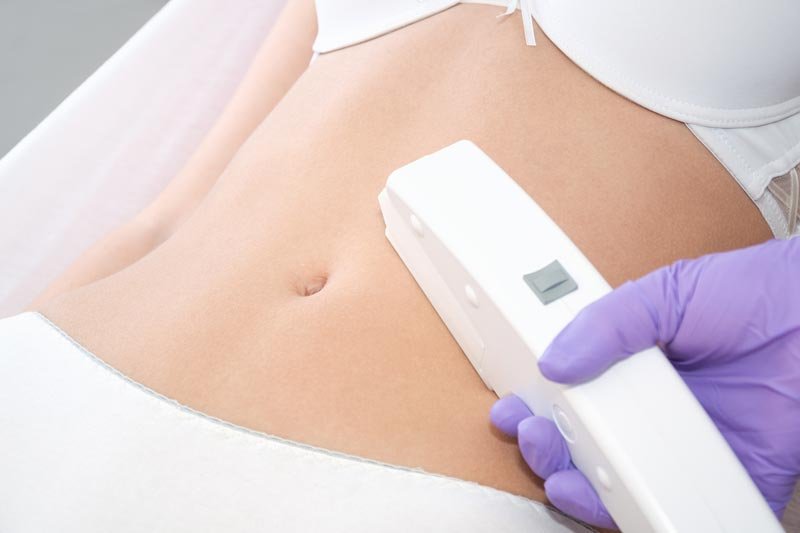 Linea de abdomen