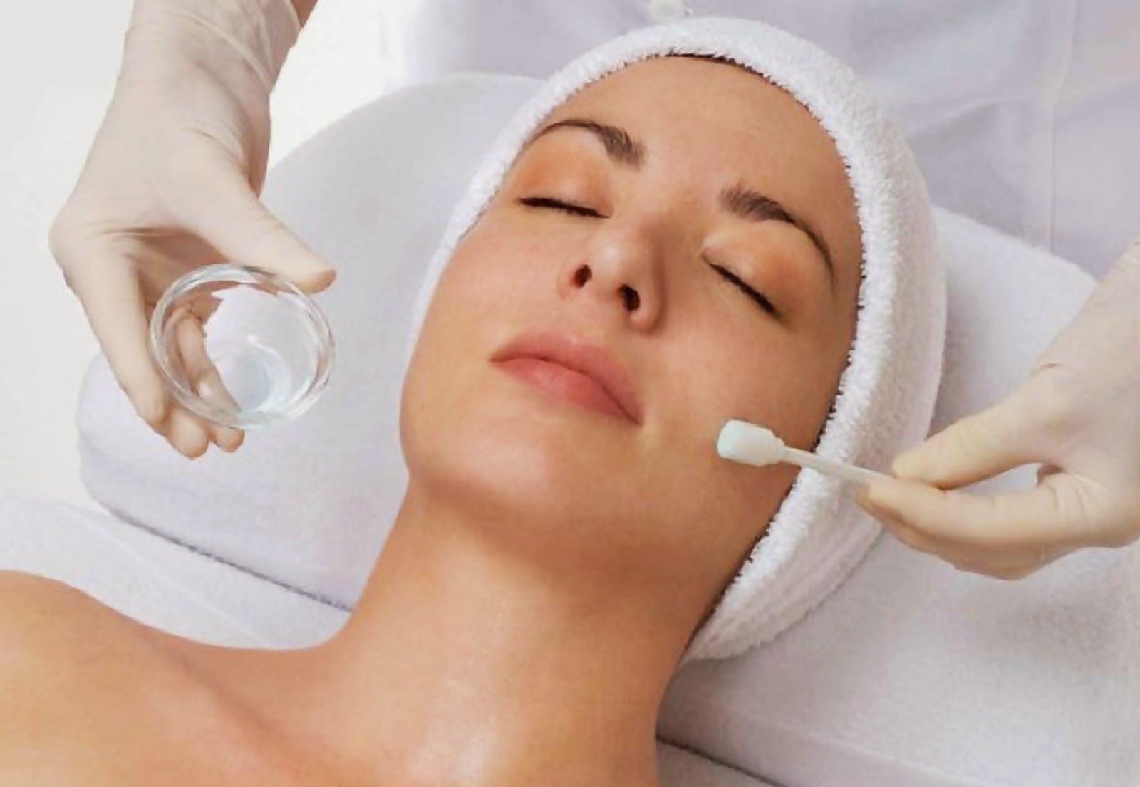 Facial para acne activo y marcas de Acné