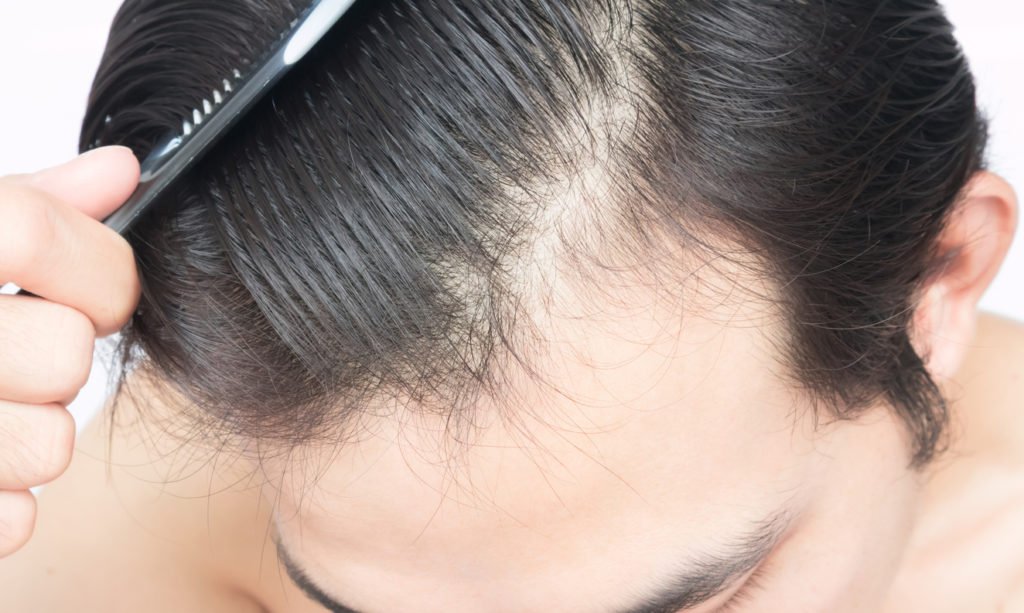 Camuflaje capilar pelo a pelo