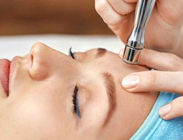 Microdermoabrasión + Limpieza Clinica + Alta frecuencia