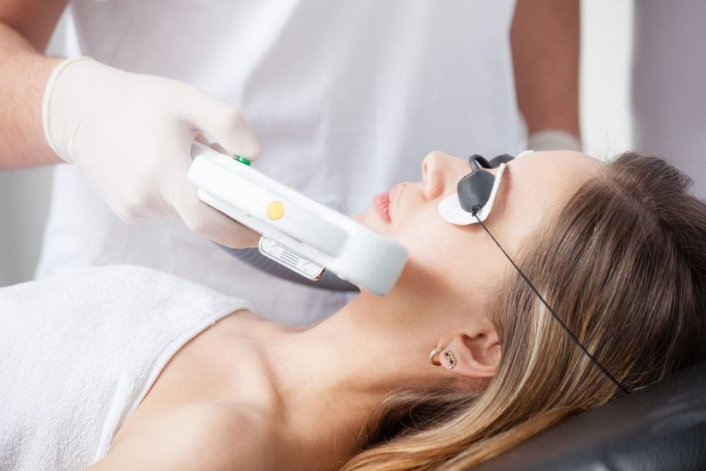 Lasér para Acne 1 ses.
