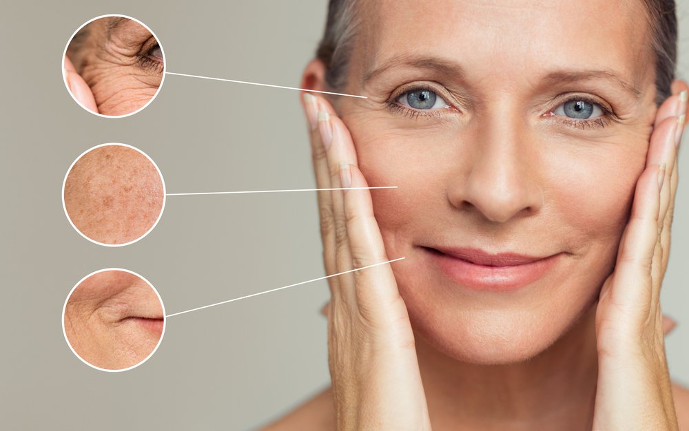 Sculptra Facial