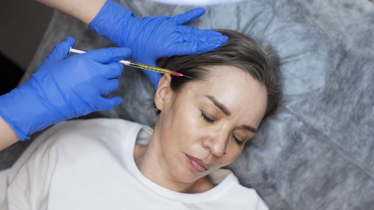 PRP facial: qué es el plasma rico en plaquetas y qué puede esperarse