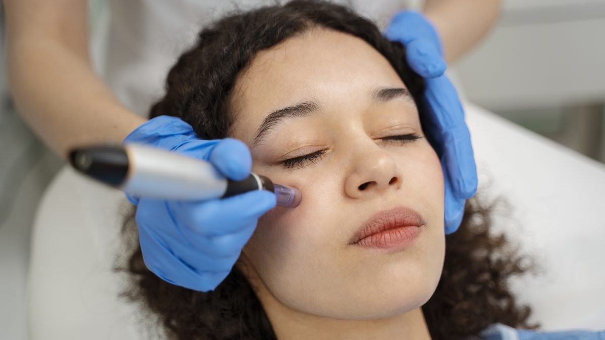 SkinPen y microneedling frente al Botox y rellenos faciales