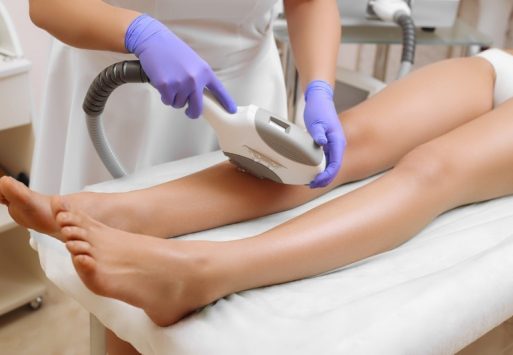 laser-piernasenteras