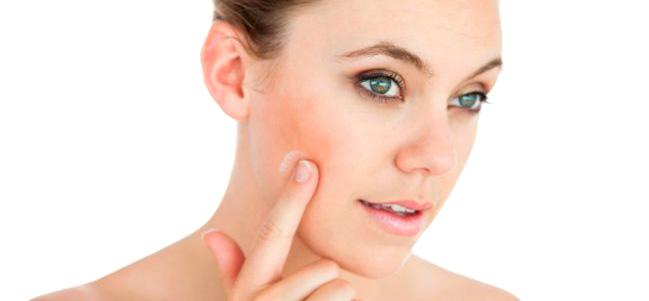 Láser para Rosácea